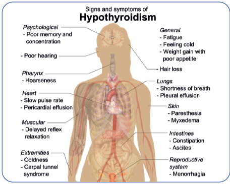 Hypothyroidism - Types, Causes and Recommendations