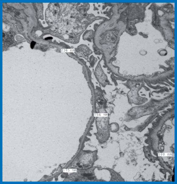 First Private Lab in India to Introduce Electron Microscopy - Dr Lal ...