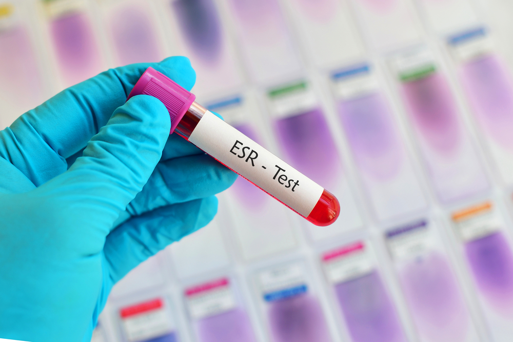 what is esr in blood test