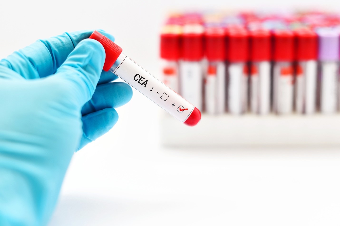 What is a CEA blood test?
