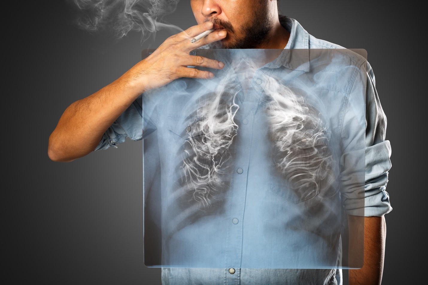 lung cancer symptoms