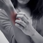 What are the types of skin rash? What are the types of skin rash?