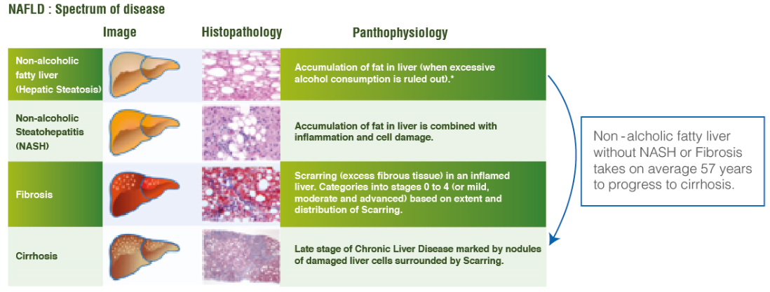 spectrum of disease