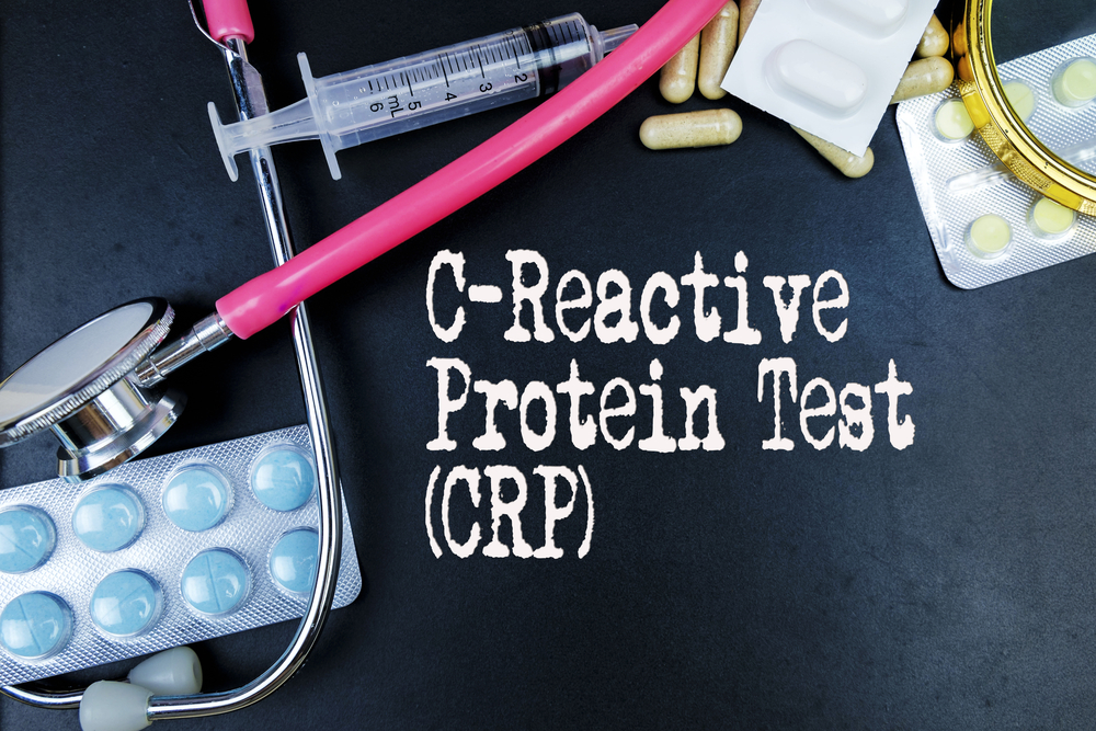 These Facts About C Reactive Protein Test Are Quite Interesting
