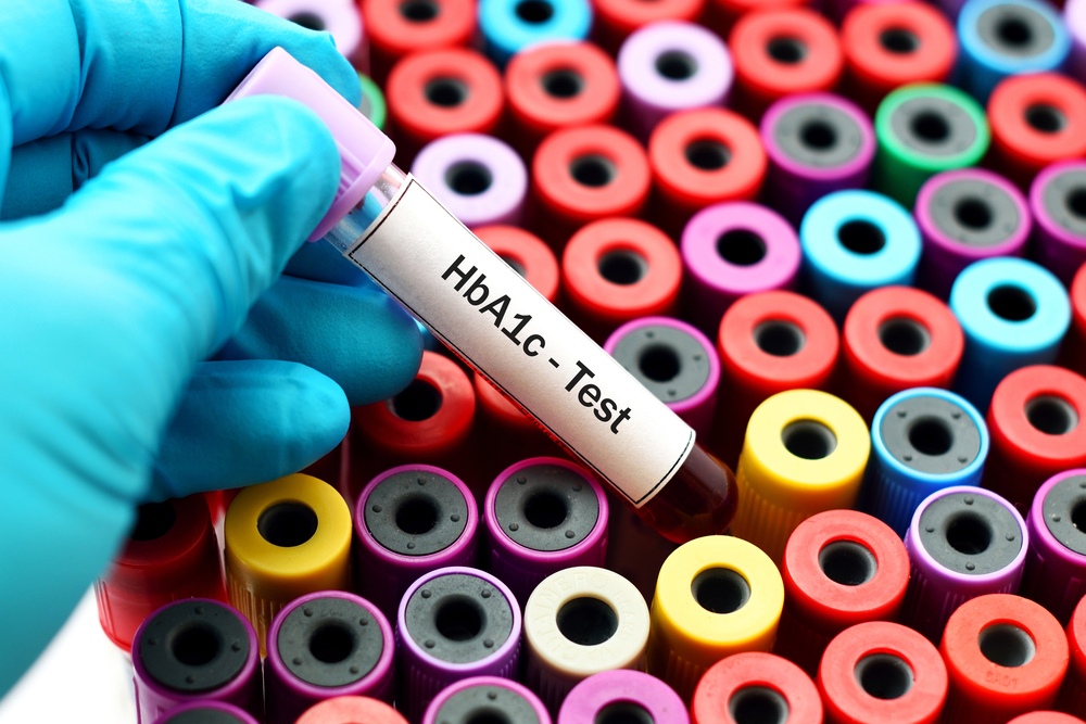 hba1c test