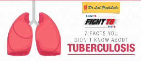 7 Facts You Didn’t Know About Tuberculosis (TB)