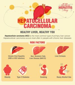 28th July, World Hepatitis Day : Hepatocellular Carcinoma – Healthy Liver, Healthy You 28th July, World Hepatitis Day : Hepatocellular Carcinoma – Healthy Liver, Healthy You