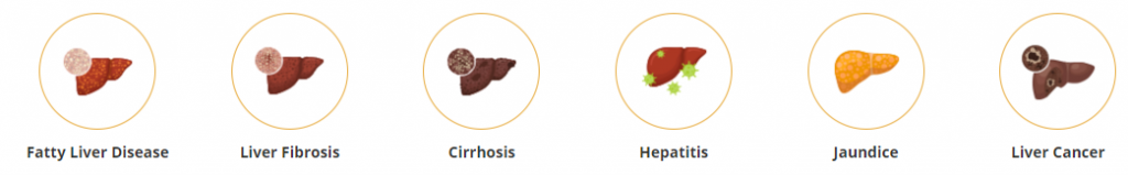 Liver-Diseases-Types