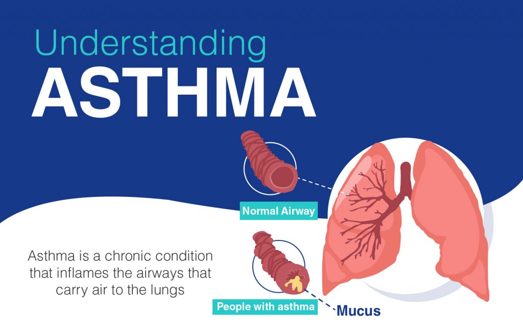 Understanding Asthma Causes Symptoms And Treatment Dr Lal 