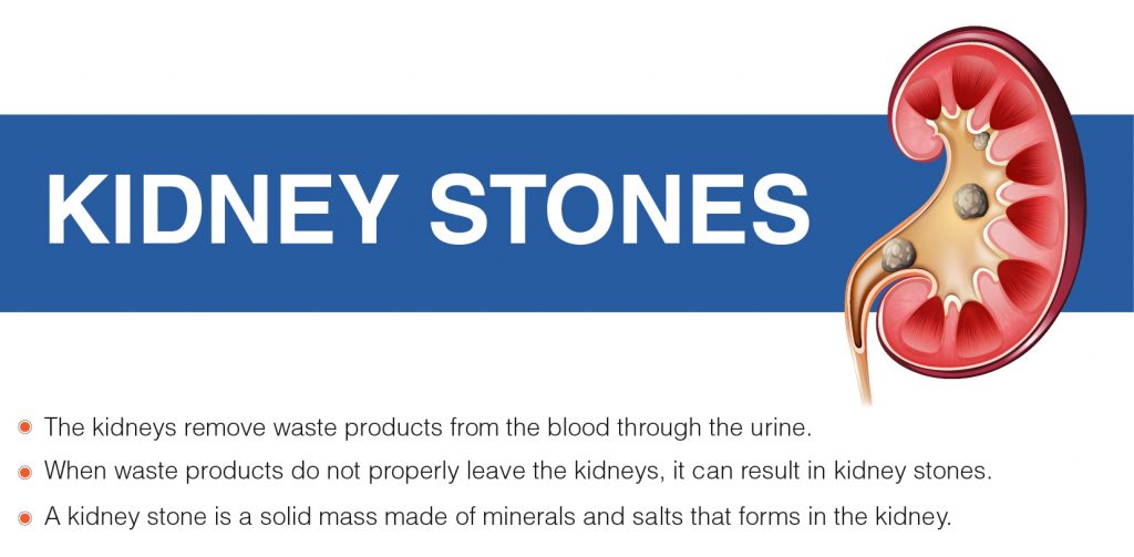 Kidney Stones 