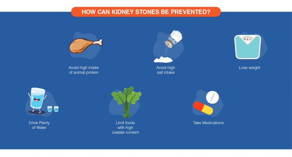 Kidney stones prevention
