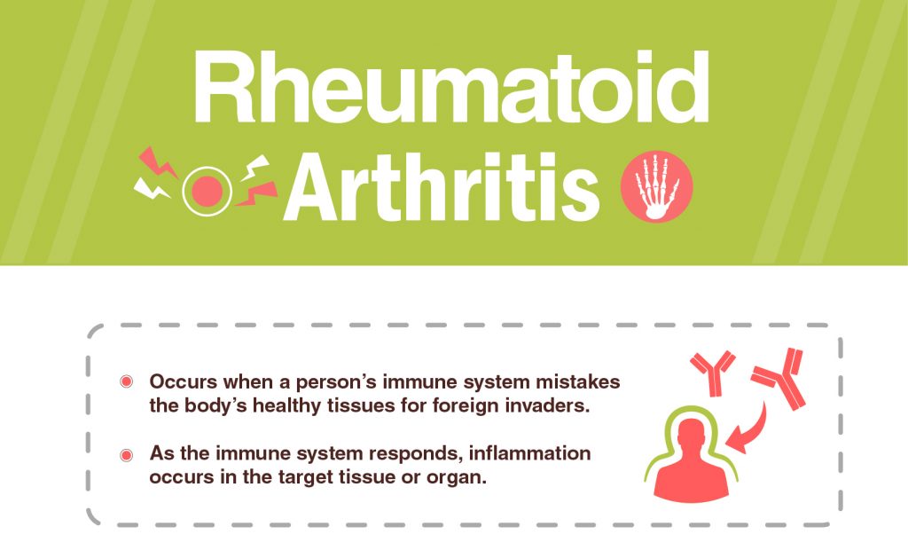 Rheumatoid Arthritis: Signs, Symptoms & Treatment