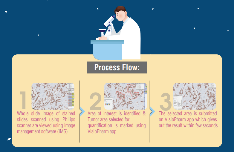 breast-cancer-philips-scanner