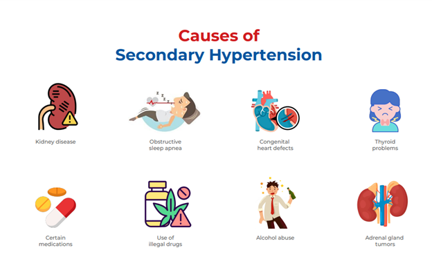 causes of secondary hypertension