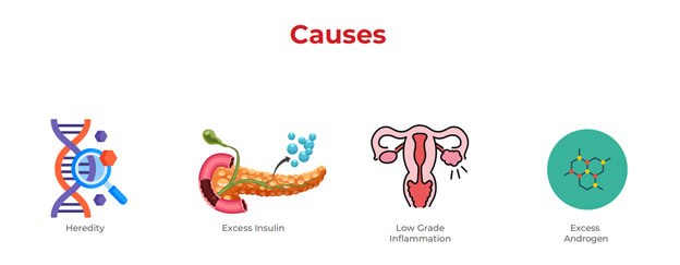 causes of PCOS