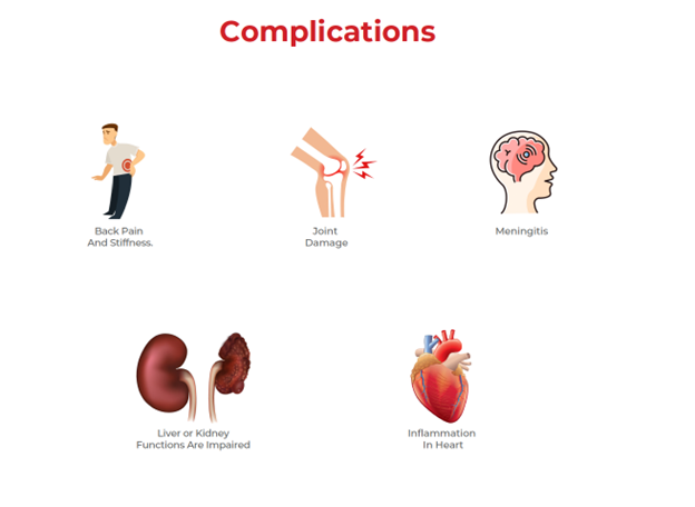 Complications associated with TB