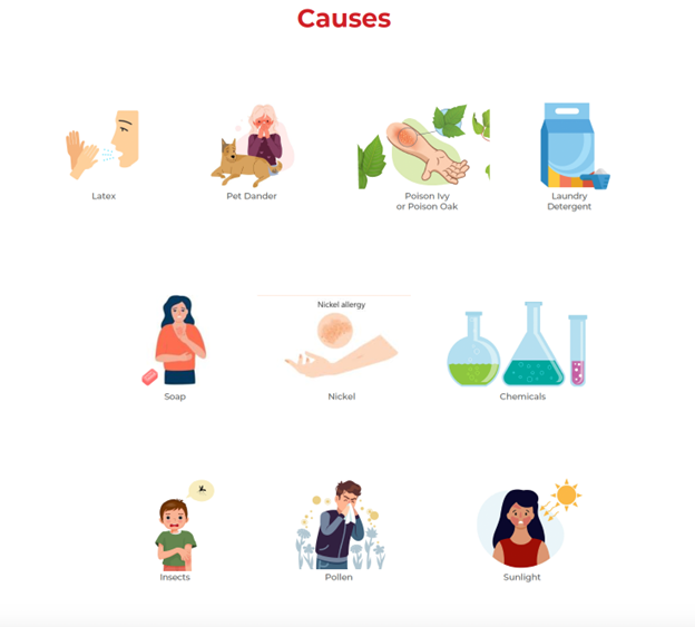 causes of skin allergy