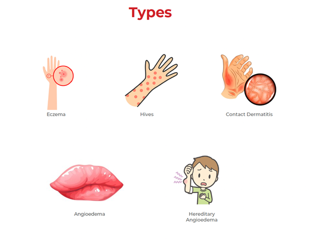 types of skin allergy