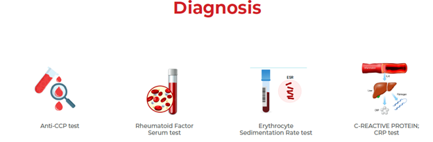 diagnosis of rheumatoid arthritis