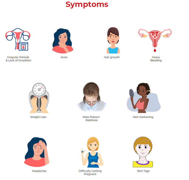 symptoms of PCOS