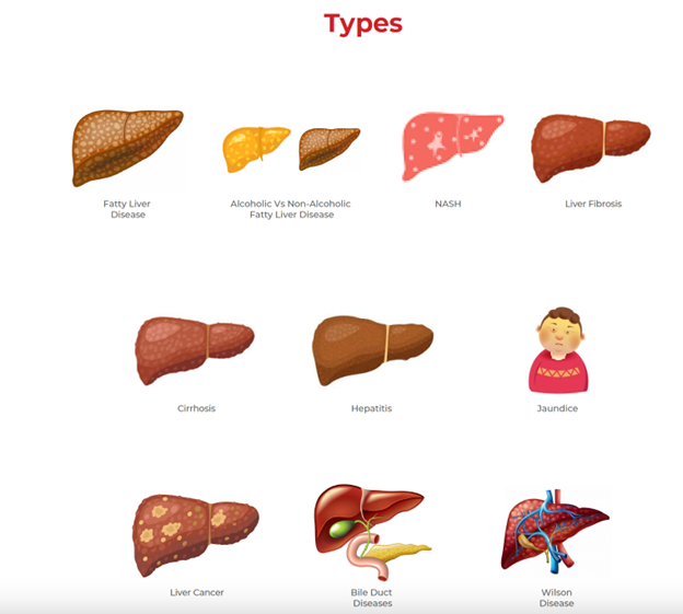 types of liver disease