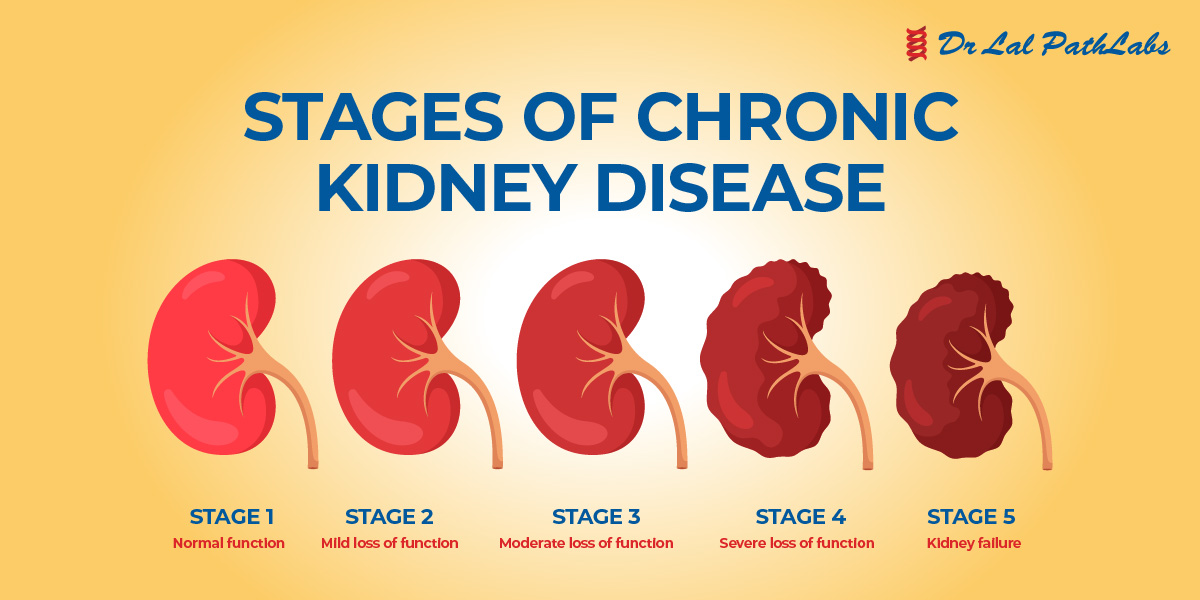 Kidney Disease Types Symptoms And Diagnosis Dr Lal Pathlabs Blog