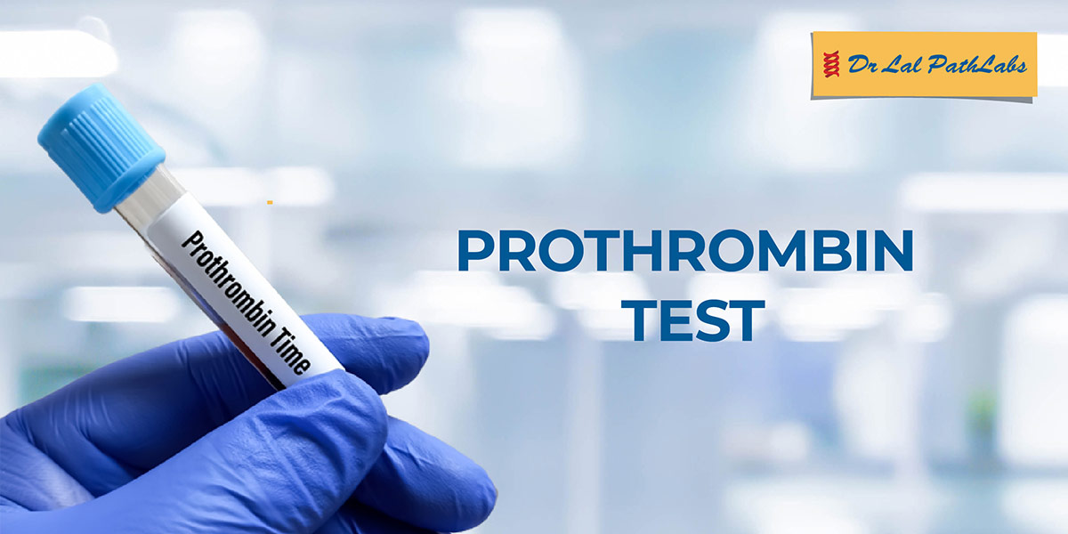 prothrombin