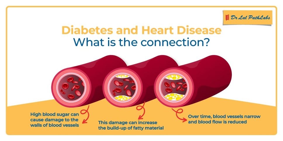 diabetes-and-heart-diseases