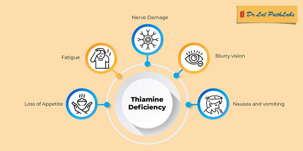 Thiamine Deficiency Understanding the Importance of Vitamin B1 Dr