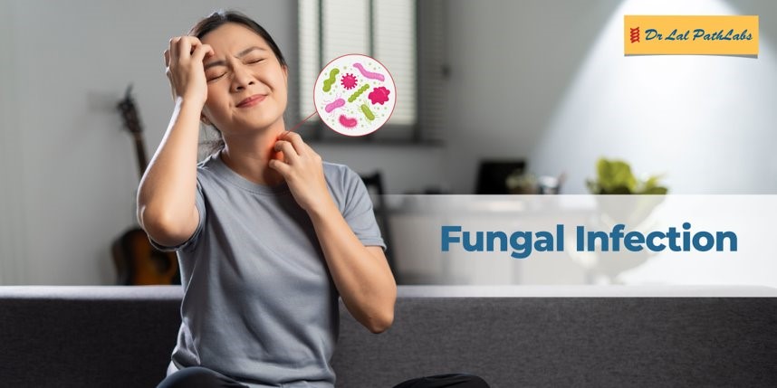 fungal-infection
