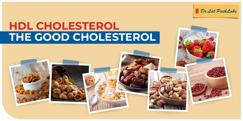 hdl-cholesterol