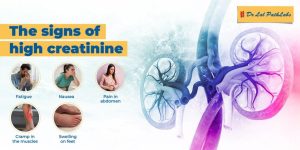 High Creatinine Levels: Symptoms and Testing High Creatinine Levels: Symptoms and Testing