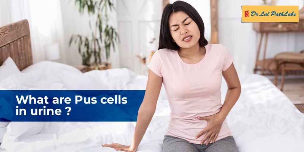 Pus Cells in Urine Causes & Diagnosis Dr. Lal PathLabs