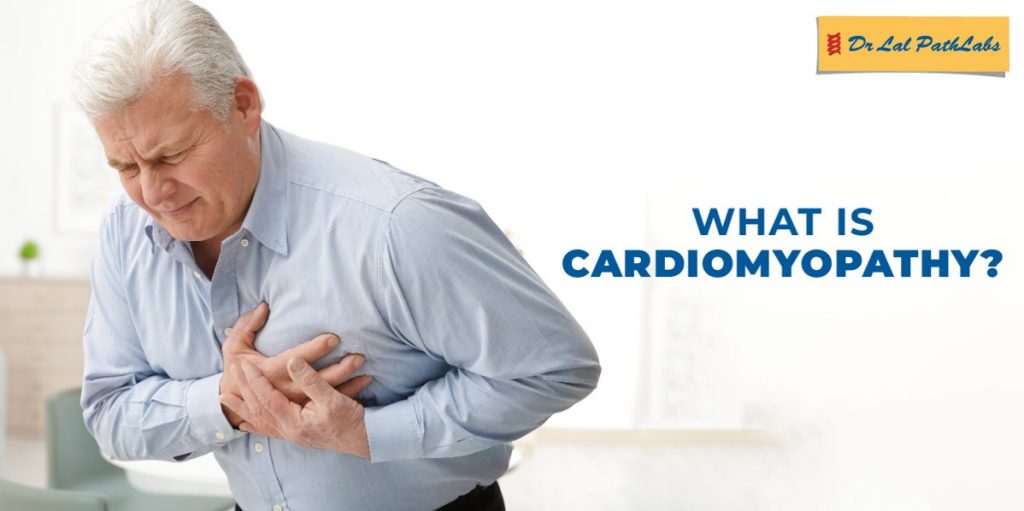 Cardiomyopathy