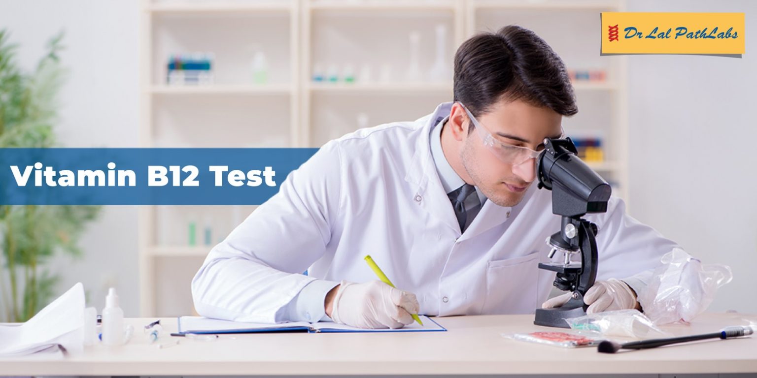 Know Your Test Vitamin B12 Test Dr Lal PathLabs Blogs