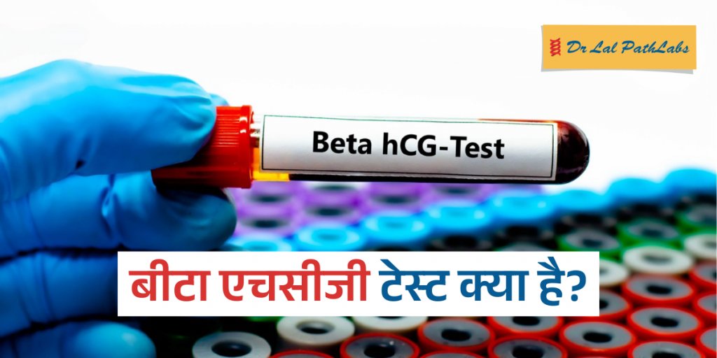 बीटा HCG टेस्ट क्या है और क्यों किया जाता है