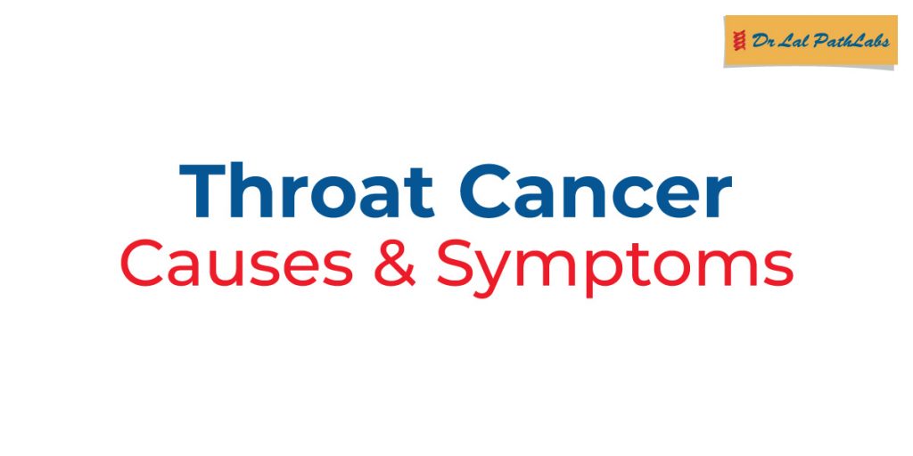 throat-cancer