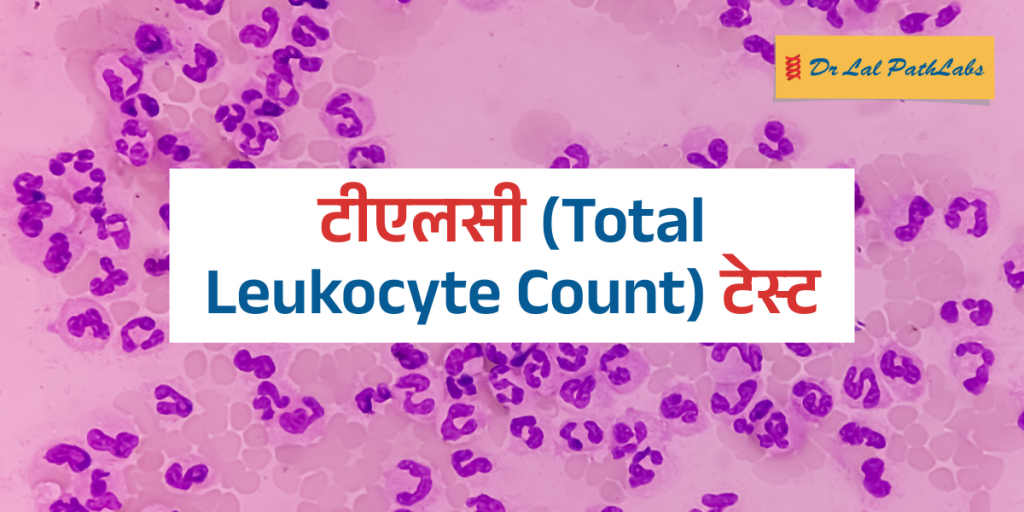 टीएलसी (Total Leukocyte Count) टेस्ट का महत्व और परिणाम