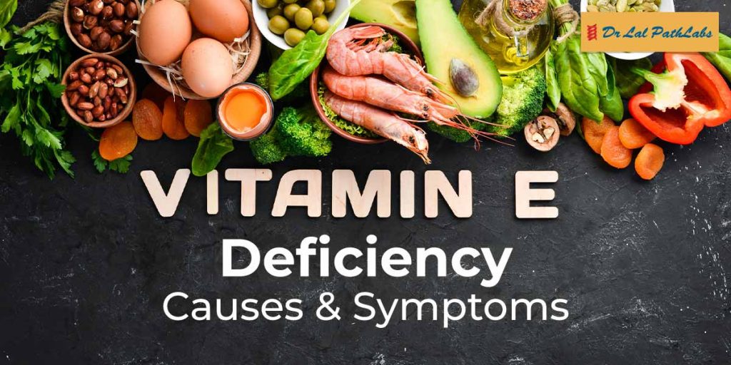 Vitamin E Deficiency: Causes, Symptoms, and Diagnosis