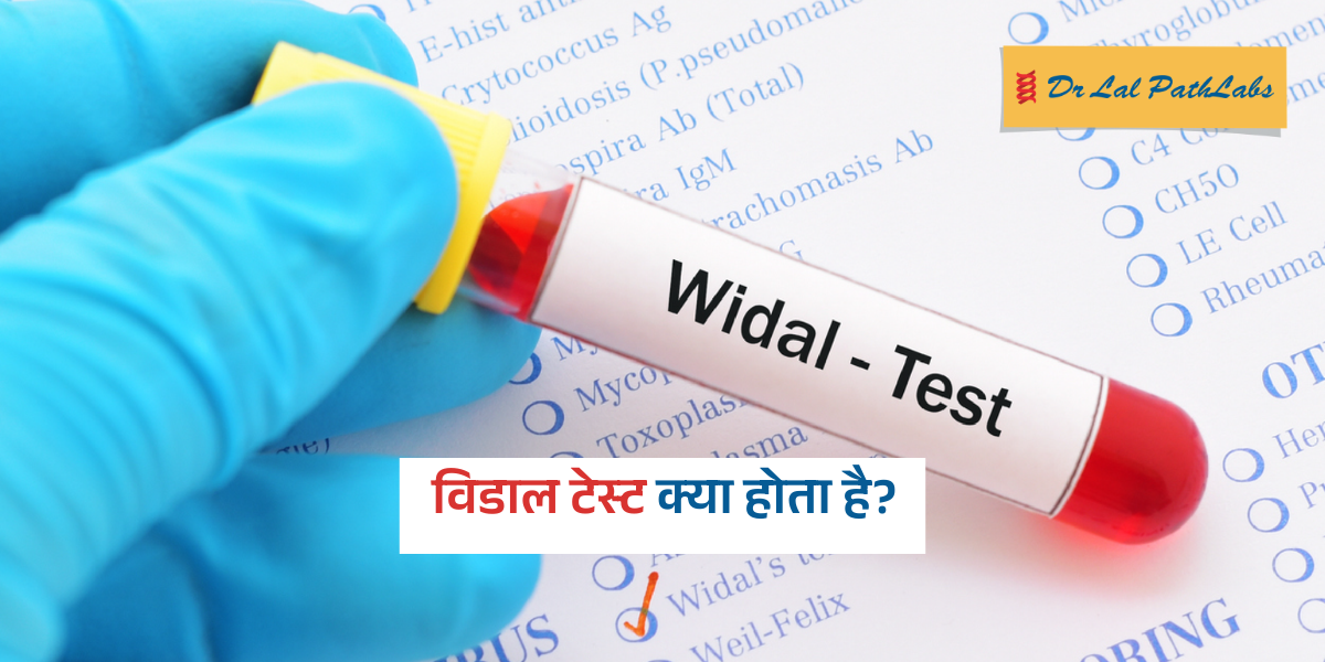Widal test in Hindi