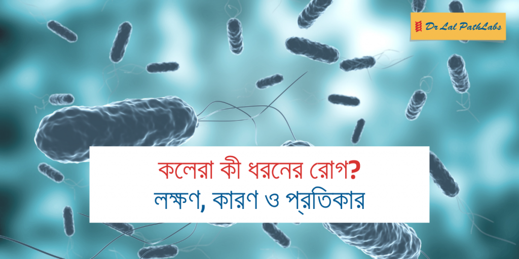কলেরা কী ঘটিত রোগ? লক্ষণ, কারণ ও প্রতিকার
