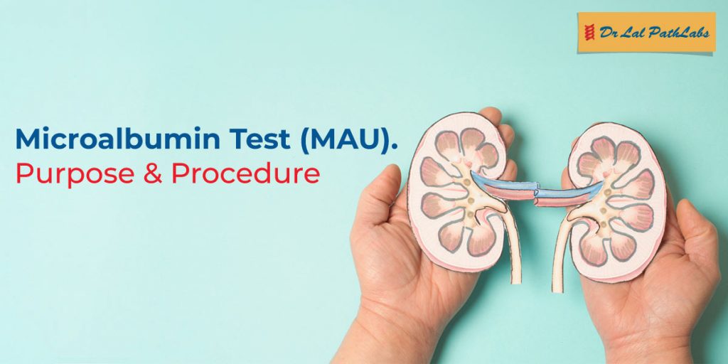Microalbumin Test (MAU): Purpose, Procedure & Normal Range