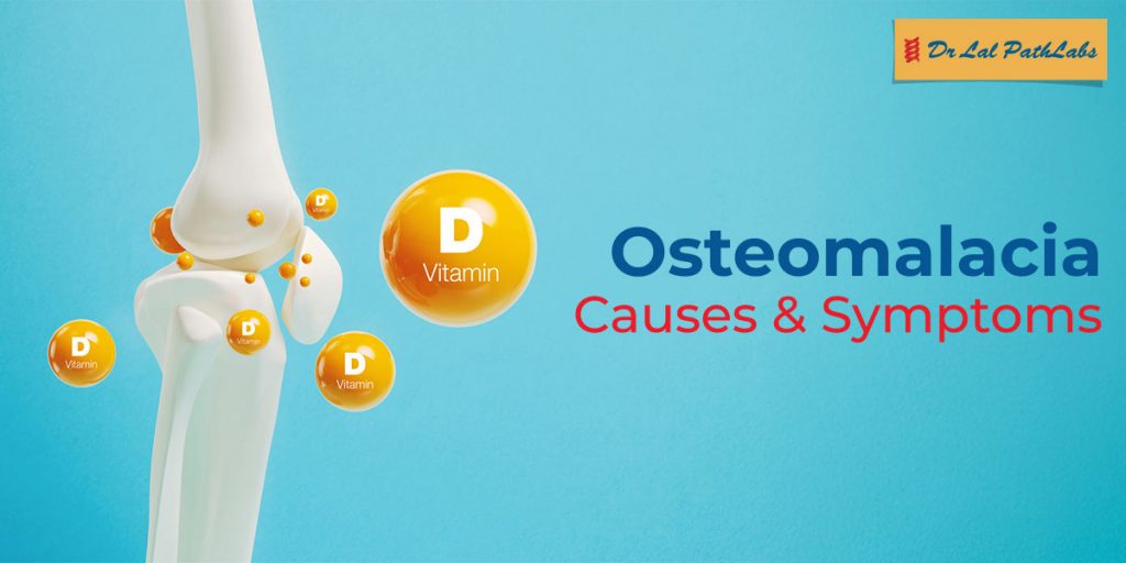 Osteomalacia: Symptoms, Causes & Treatment