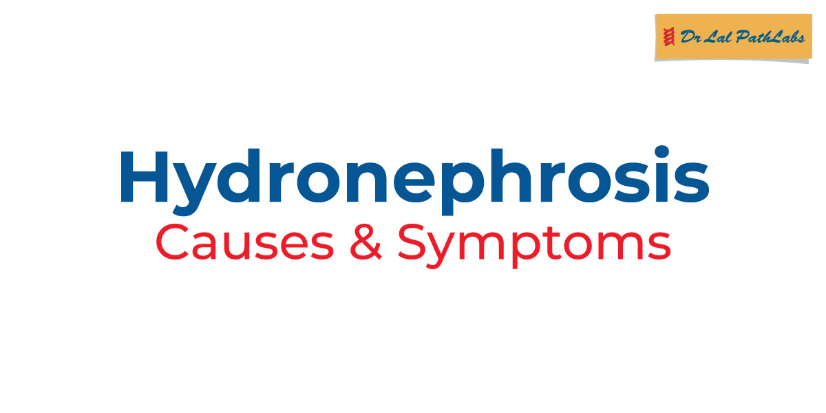 hydronephrosis