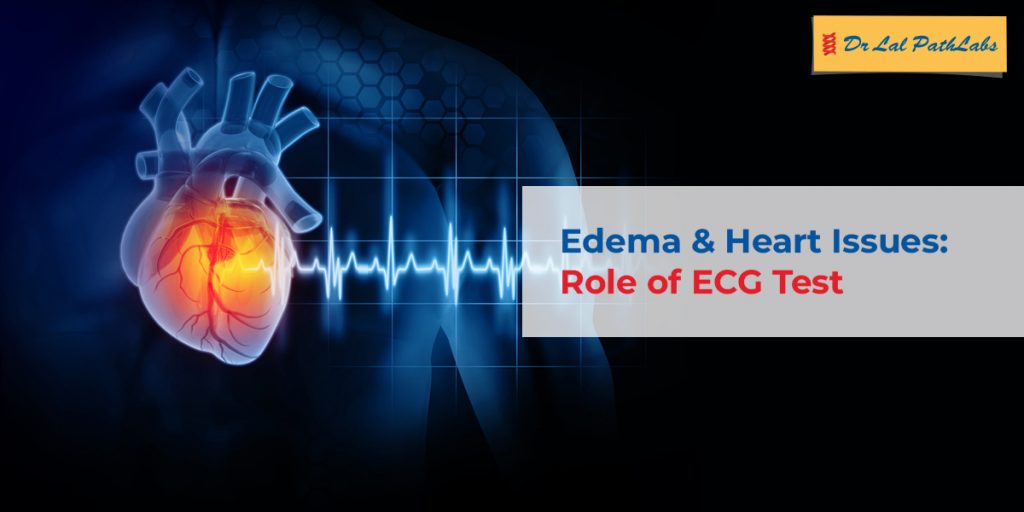 Edema and Heart Problems: How an ECG Test Can Help Identify the Cause