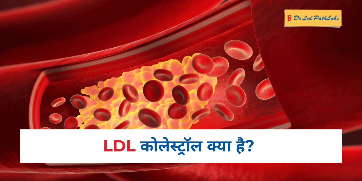 LDL cholesterol in Hindi