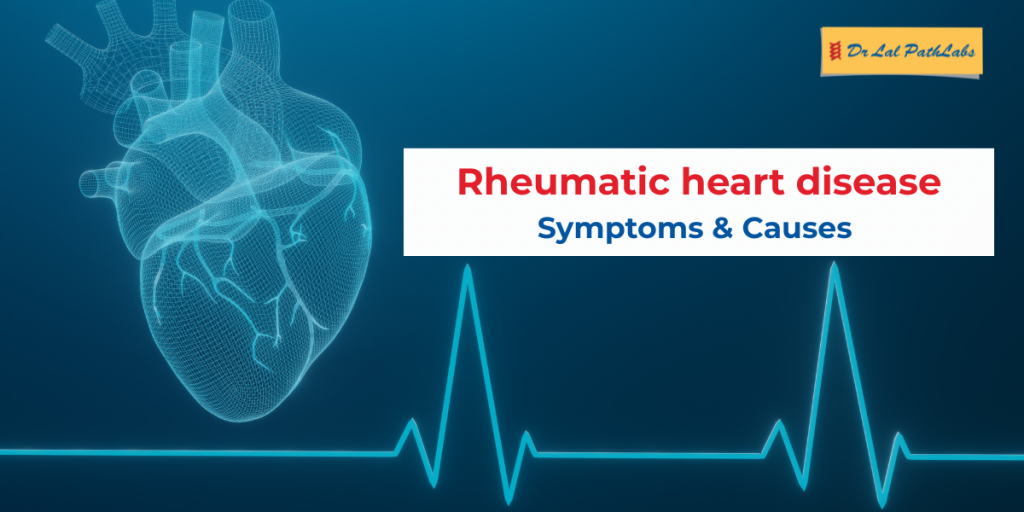 rheumatic heart disease