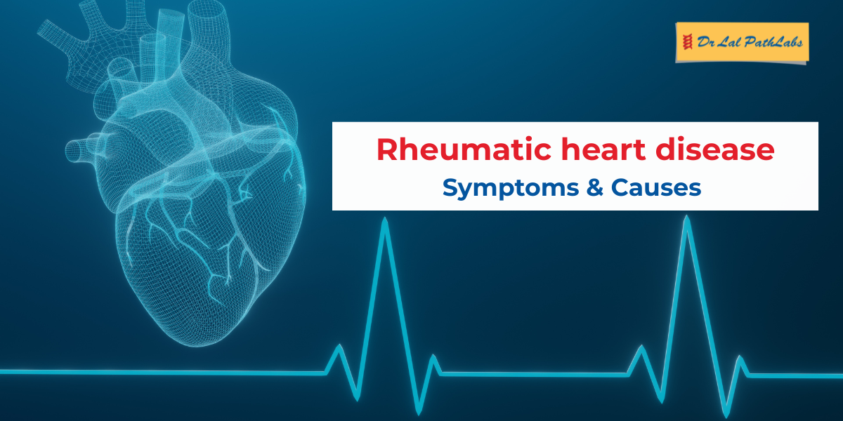 rheumatic heart disease