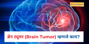 ब्रेन ट्यूमर