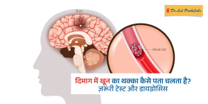 दिमाग में खून का थक्का कैसे पता चलता है